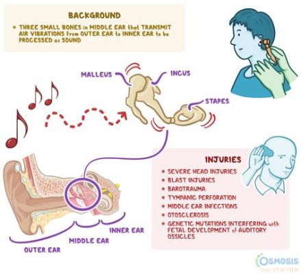 Why Does My Music Get Quiet When I Open My Phone – Exploring the Hi-Tech Phenoera